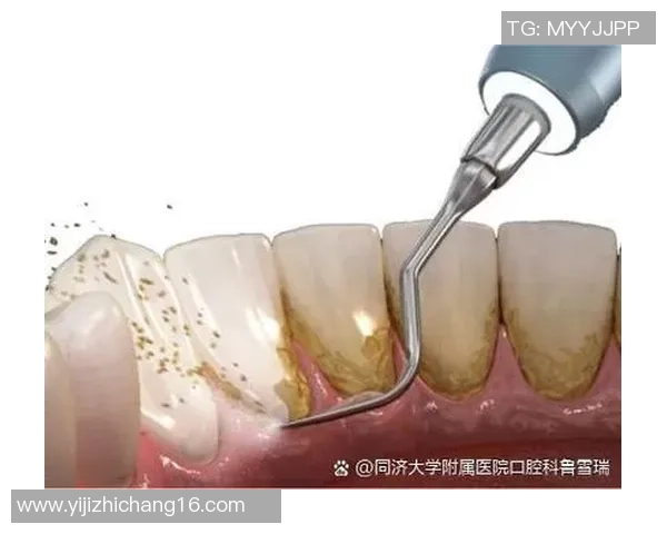 踢足球牙的趣味与挑战探讨如何在运动中保护口腔健康